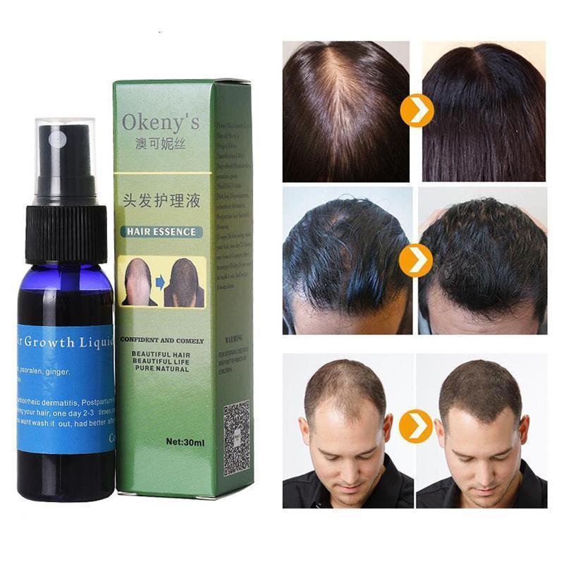 Sunburst Hair Growth Products for Women & Men- Anti hair loss products